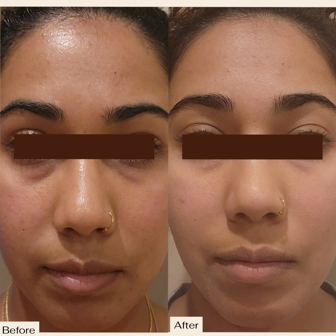 Pro Ageing VS-1 Serum