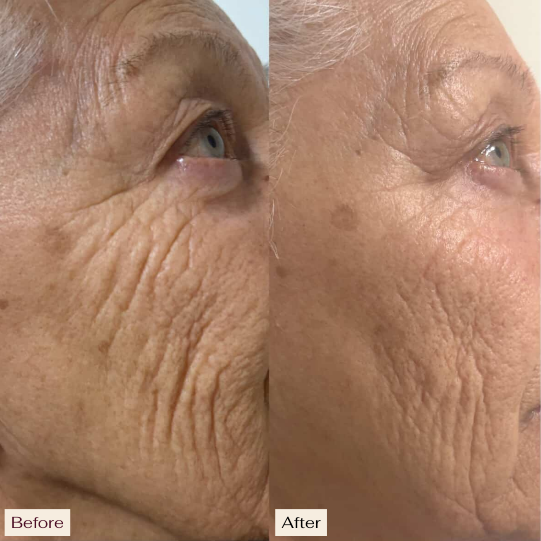 Pro Ageing VS-1 Serum
