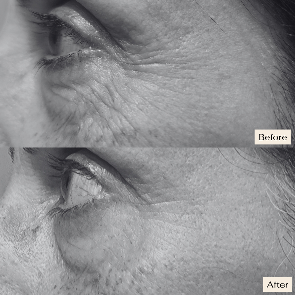 Pro Ageing VS-1 Serum