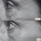 Pro Ageing VS-1 Serum