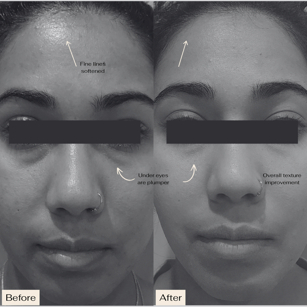 Pro Ageing VS-1 Serum