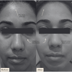 Pro Ageing VS-1 Serum