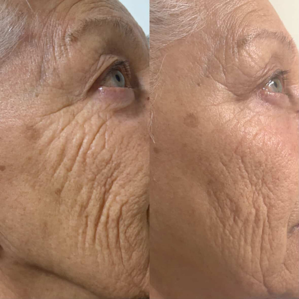 Pro Ageing VS-1 Serum